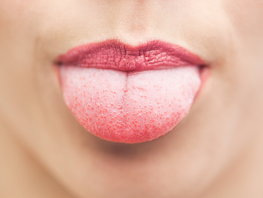 Tongue health